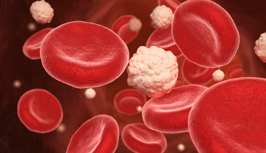 Glicose alta, baixa e normal O que significa? Delboni